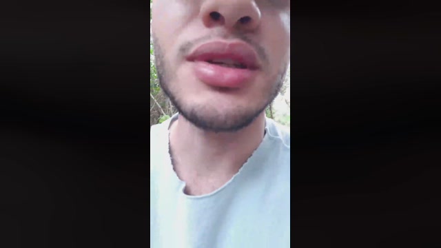 Synbaherrera  20-09-2022